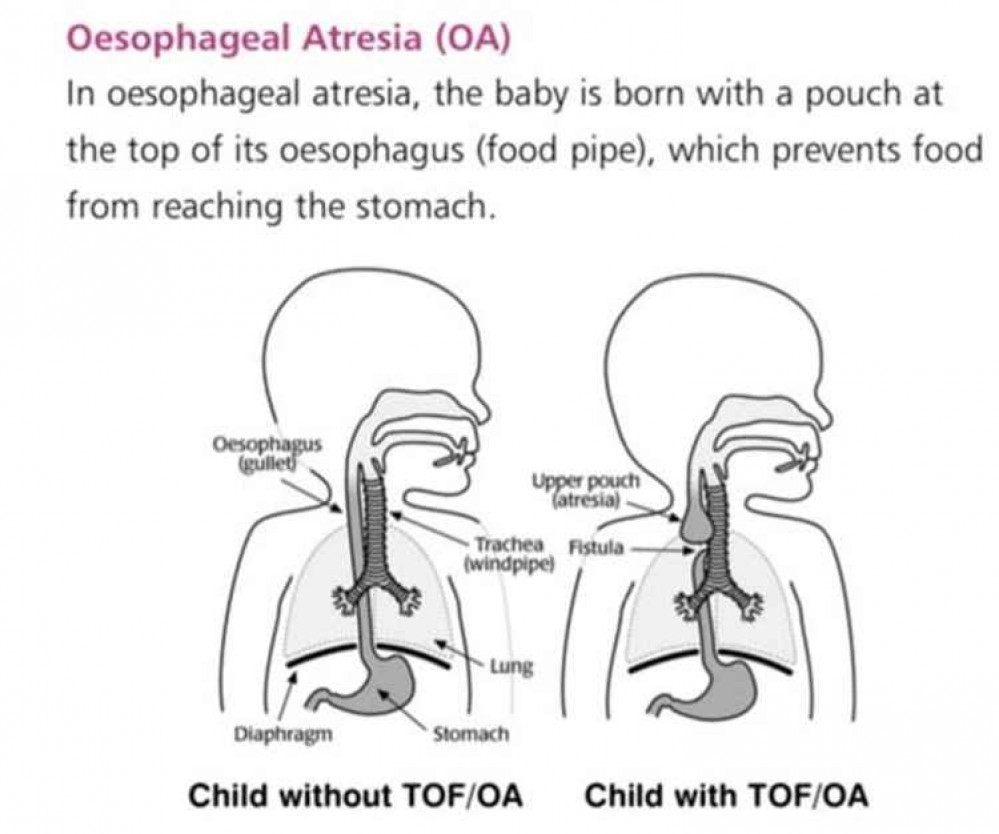 The TOF condition.