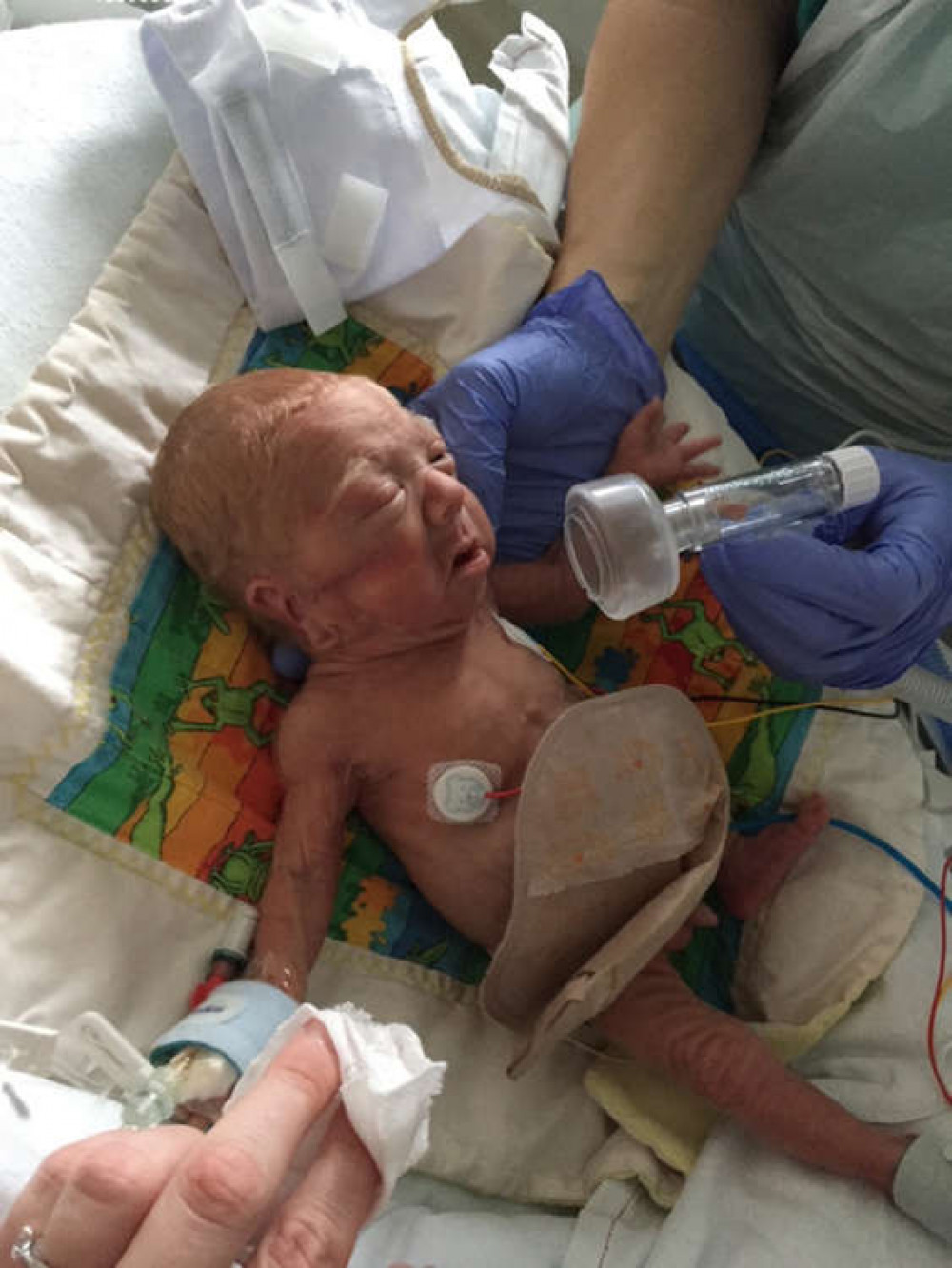 Freddie being treated at Addenbrooke's Hospital.