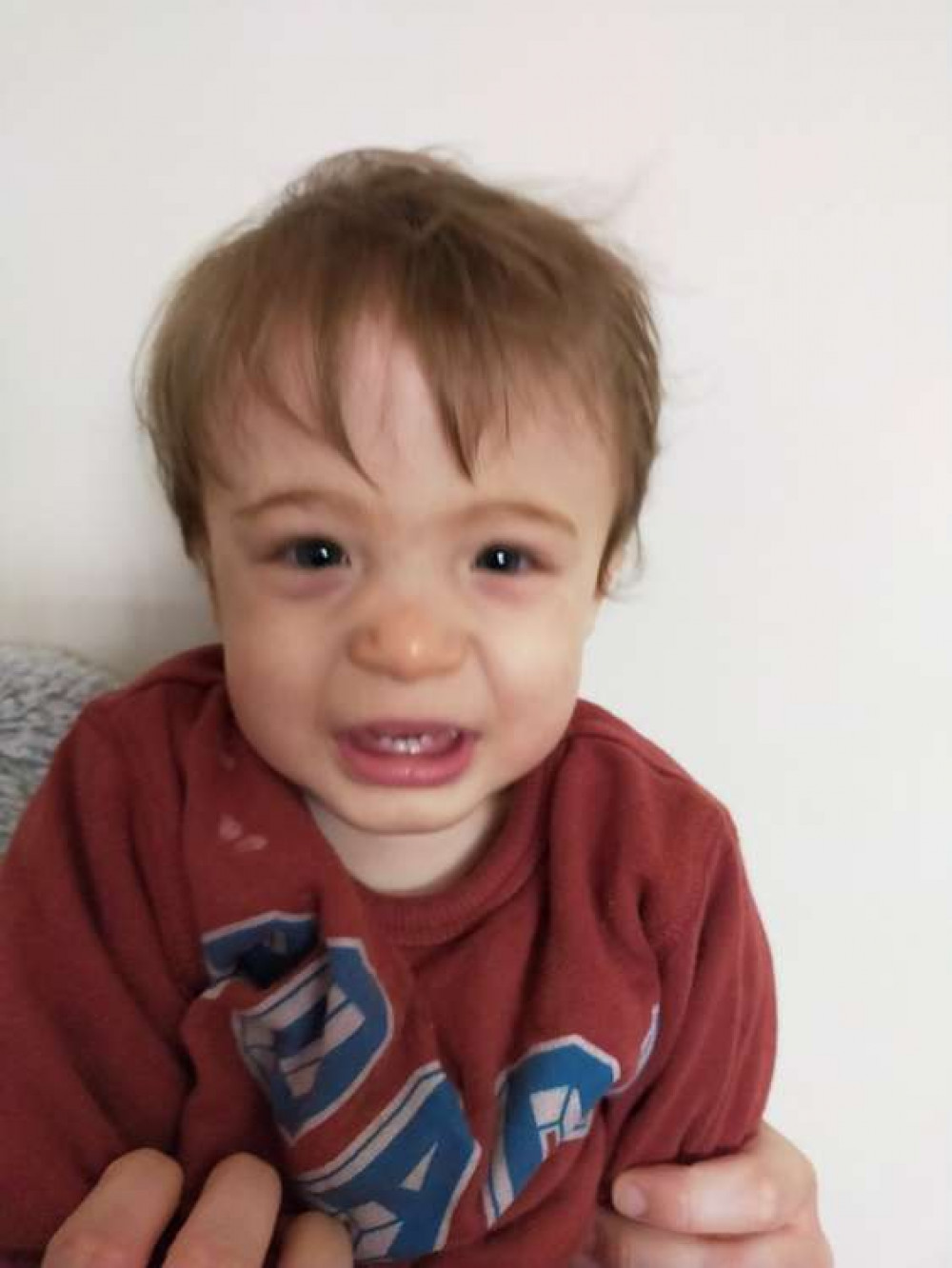 Dean was born with an extremely rare condition called ZTTK syndrome