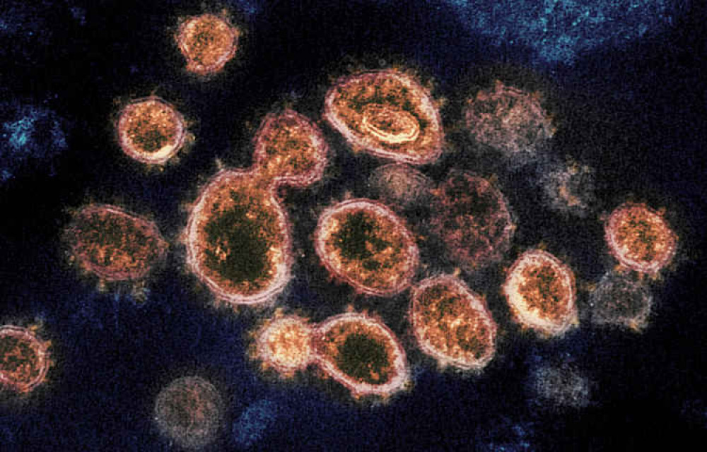 There was an increase of over 42% in the number of new coronavirus cases. Image Credit: NIH Image Gallery