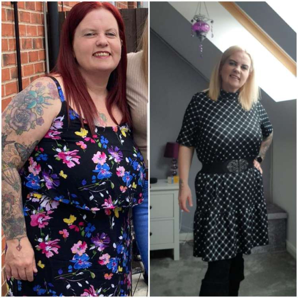 The before and after photos show how much weight Joanne has lost