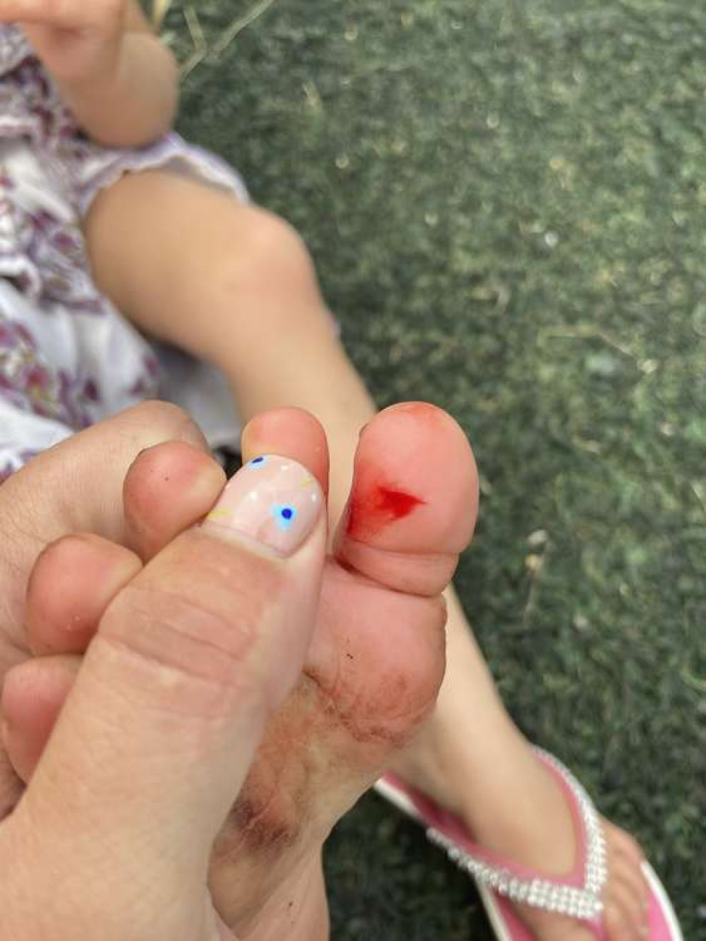 Evalyn's cut foot