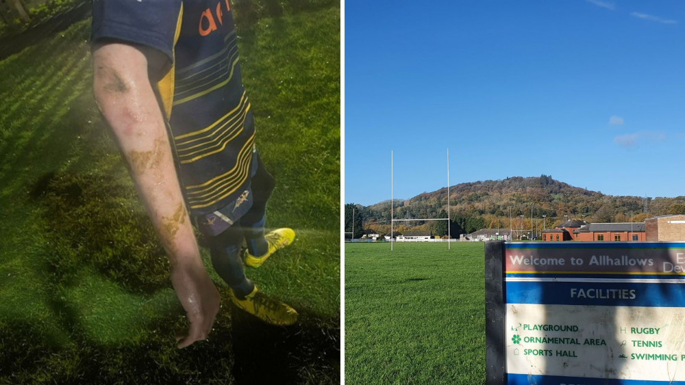 L: A player with dog mess on his arm (Credit: Jeremy Rice) L: Allhallows Playing Fields L: A player with dog mess on his arm (Credit: Jeremy Rice) L: Allhallows Playing Fields