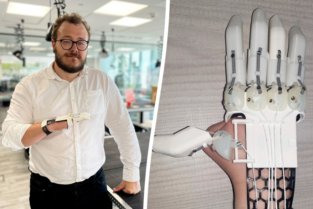 Staffordshire University student, Luke Cox, 26, designed the artificial hand for his final year project (SWNS).