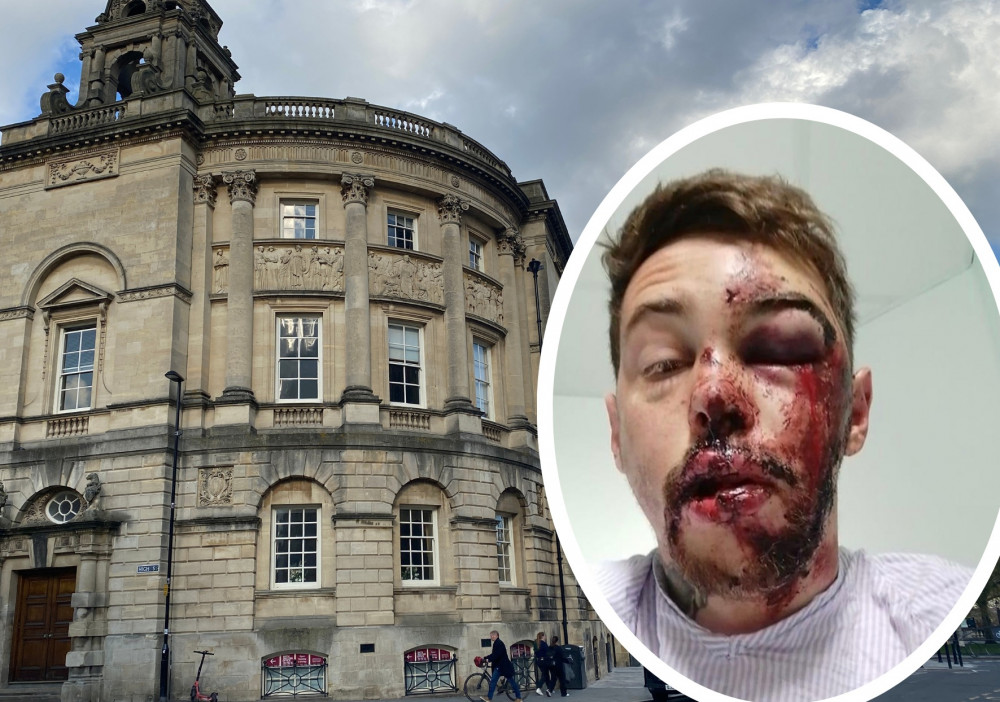 William Bullock after the accident with (background) the Guildhall where Bath and North East Somerset Council meet (Image: (inset) William Bullock and (background)