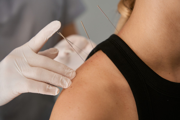 Learn how acupuncture can help you beat allergies and heat-related fatigue this summer (Credit: True Physio)