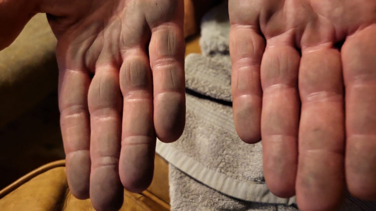 The effect of dust coming from Aberthaw Quarry. A number of residents in Fonmon and Font-y-Gary said their property and possessions have been covered in black dust.