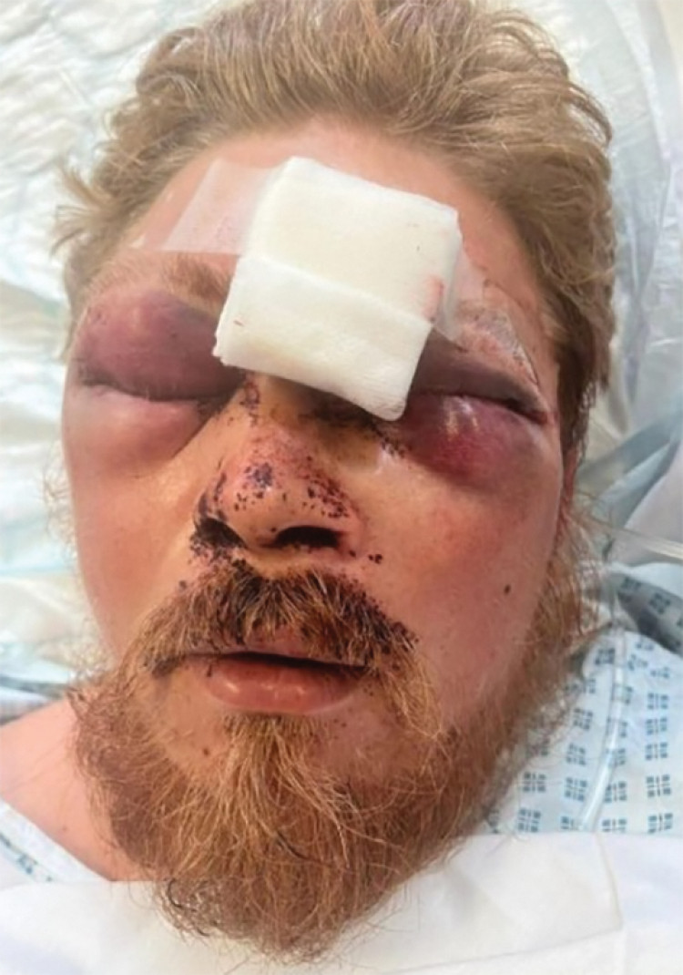 Kaisen Kinsella in hospital. 