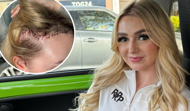 A PE teacher from Macclesfield was diagnosed with a brain tumour, having initially been told her headaches were caused by the contraceptive pill (Credit: SWNS)