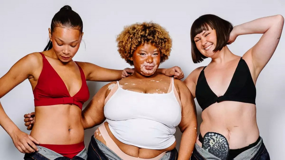 Every model to travel the runway at the show from RECONDITION is disabled or chronically ill (Image supplied)