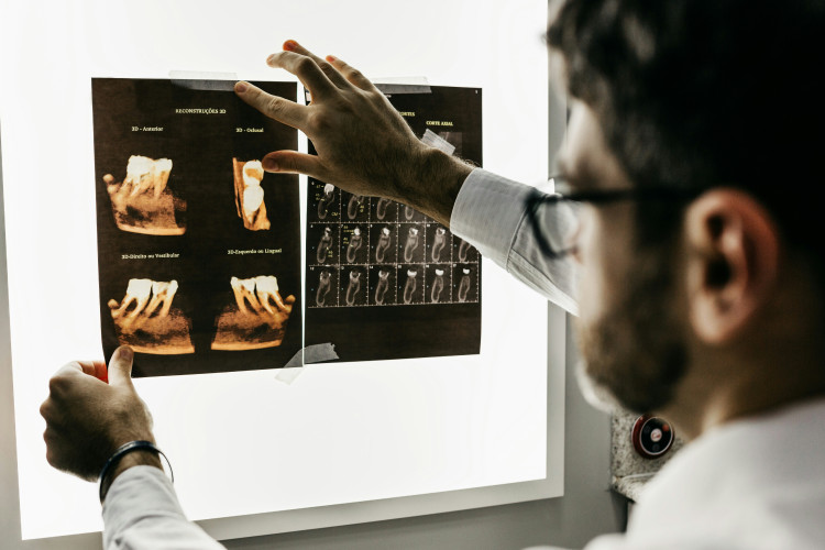 Somerset NHS dentistry is improving, but the small print matters. (Photo: Unsplash) 