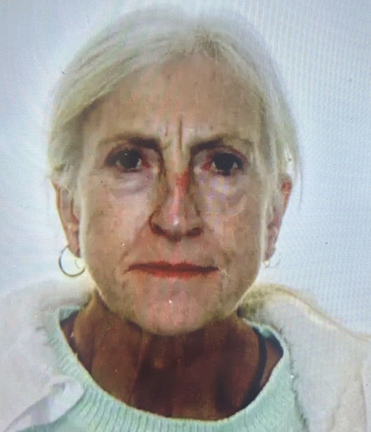 A Kenilworth woman has been reported missing. Those with information on her whereabouts should call 999 or 101 with incident number 227 if spotted (image via Warwick Police)